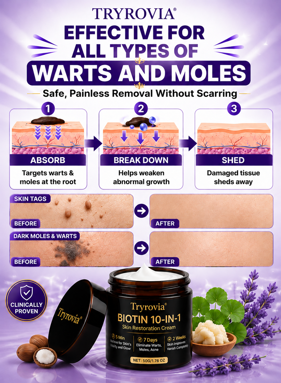 Advanced Support for Skin Tags, Warts & Abnormal Skin Growths
