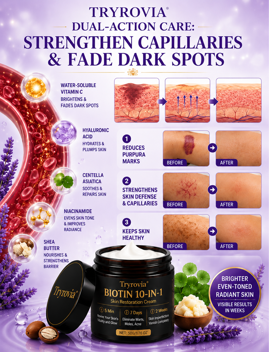 Brightens Dark Spots, Purpura & Evens Out Uneven Skin Tone